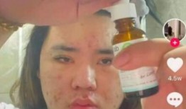 八卦吃瓜网红视频,揭秘娱乐圈幕后故事